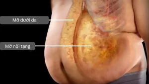 Giảm béo an toàn là quá trình giảm lượng mỡ dư thừa trong cơ thể một cách khoa học